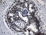 ZKSCAN1 Antibody in Immunohistochemistry (Paraffin) (IHC (P))