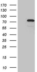 ZKSCAN1 Antibody in Western Blot (WB)