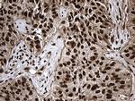 ASH2L Antibody in Immunohistochemistry (Paraffin) (IHC (P))