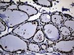 ASH2L Antibody in Immunohistochemistry (Paraffin) (IHC (P))