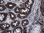 PCCA Antibody in Immunohistochemistry (Paraffin) (IHC (P))