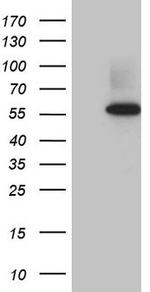 RNF14 Antibody in Western Blot (WB)