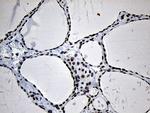 NABP1 Antibody in Immunohistochemistry (Paraffin) (IHC (P))