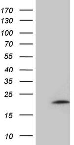 MMGT1 Antibody in Western Blot (WB)