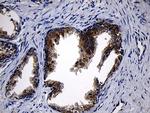 CCDC22 Antibody in Immunohistochemistry (Paraffin) (IHC (P))