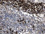 CCDC22 Antibody in Immunohistochemistry (Paraffin) (IHC (P))