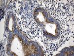 CCDC22 Antibody in Immunohistochemistry (Paraffin) (IHC (P))