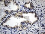 CCDC22 Antibody in Immunohistochemistry (Paraffin) (IHC (P))