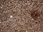 GNPAT Antibody in Immunohistochemistry (Paraffin) (IHC (P))