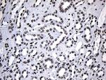 SF3B14 Antibody in Immunohistochemistry (Paraffin) (IHC (P))