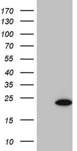 SF3B14 Antibody in Western Blot (WB)