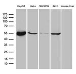 ALDH7A1 Antibody in Western Blot (WB)