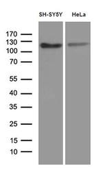 Fe65 Antibody in Western Blot (WB)