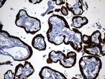 KRT84 Antibody in Immunohistochemistry (Paraffin) (IHC (P))