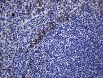 KRT84 Antibody in Immunohistochemistry (Paraffin) (IHC (P))