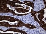 KRT84 Antibody in Immunohistochemistry (Paraffin) (IHC (P))