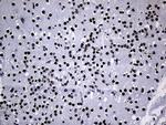 PPAR delta Antibody in Immunohistochemistry (Paraffin) (IHC (P))