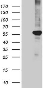 PPAR delta Antibody in Western Blot (WB)