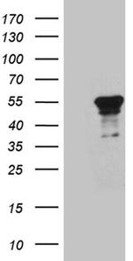 YBX2 Antibody in Western Blot (WB)