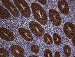 ALDH7A1 Antibody in Immunohistochemistry (Paraffin) (IHC (P))