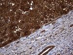 ALDH7A1 Antibody in Immunohistochemistry (Paraffin) (IHC (P))