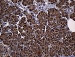 ALDH7A1 Antibody in Immunohistochemistry (Paraffin) (IHC (P))