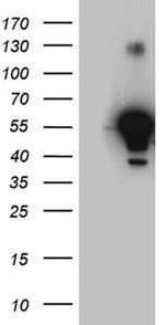 ALDH7A1 Antibody in Western Blot (WB)