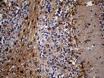 PYGM Antibody in Immunohistochemistry (Paraffin) (IHC (P))