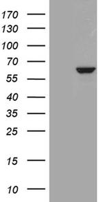 PPP2R1B Antibody in Western Blot (WB)