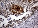 PPP2R1B Antibody in Immunohistochemistry (Paraffin) (IHC (P))