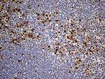 PPP2R1B Antibody in Immunohistochemistry (Paraffin) (IHC (P))