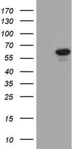 PPP2R1B Antibody in Western Blot (WB)