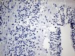 IGF2BP3 Antibody in Immunohistochemistry (Paraffin) (IHC (P))