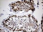 IGF2BP3 Antibody in Immunohistochemistry (Paraffin) (IHC (P))