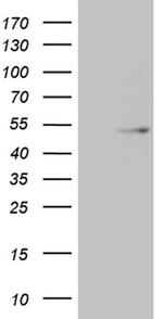 Dnmt2 Antibody in Western Blot (WB)