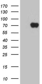 ZNF572 Antibody in Western Blot (WB)