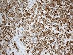 Nesprin 1 Antibody in Immunohistochemistry (Paraffin) (IHC (P))