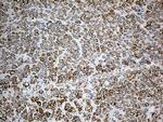 PYCR1 Antibody in Immunohistochemistry (Paraffin) (IHC (P))