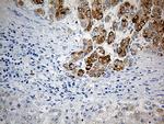 PYCR1 Antibody in Immunohistochemistry (Paraffin) (IHC (P))