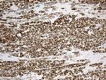 ACADM Antibody in Immunohistochemistry (Paraffin) (IHC (P))