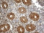 ATP5I Antibody in Immunohistochemistry (Paraffin) (IHC (P))