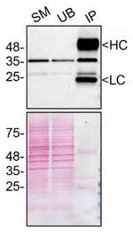 SCD Antibody in Immunoprecipitation (IP)