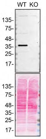 SCD Antibody in Western Blot (WB)