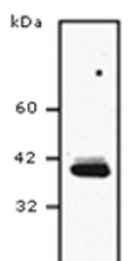 SCD Antibody in Western Blot (WB)