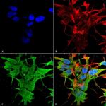 Dicer Antibody in Immunocytochemistry (ICC/IF)