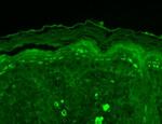 SHANK3 Antibody in Immunocytochemistry (ICC/IF)