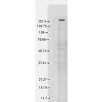 TRPM7 Antibody in Western Blot (WB)