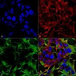 NLGN3 Antibody in Immunocytochemistry (ICC/IF)