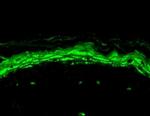 SCN10A Antibody in Immunohistochemistry (Paraffin) (IHC (P))