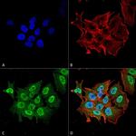 Ataxin 1 Antibody in Immunocytochemistry (ICC/IF)